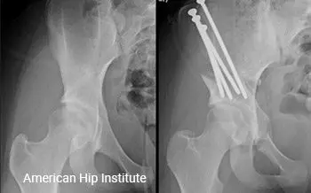 Comprehensive Hip Fellowship