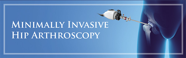 Minimally Invasive Hip Arthroscopy